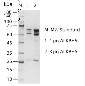 ALKBH5-2.jpg