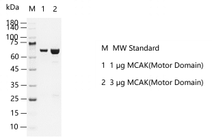 D140227021-MCAK(Motor Domain).png