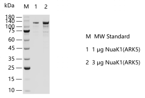 K131225011-NuaK1(ARK5).png