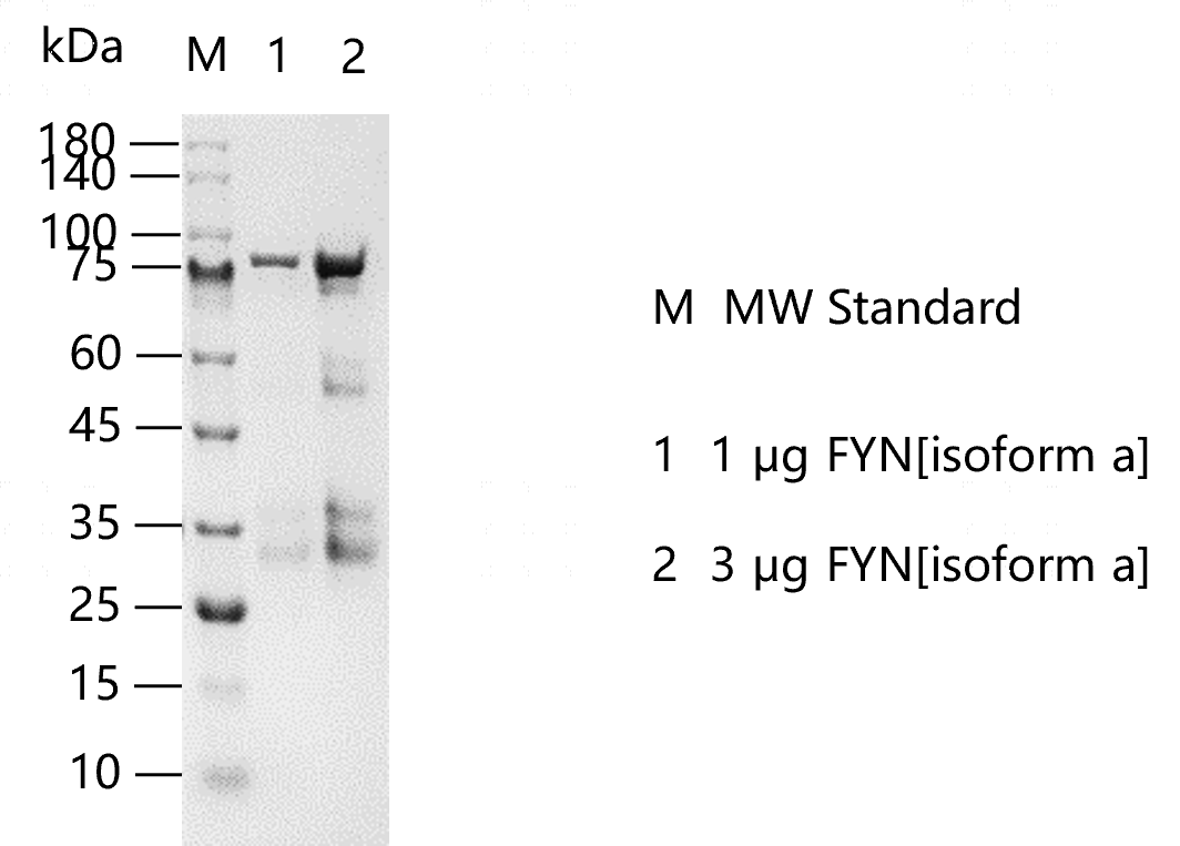 FYN[isoform a]  -G130811022.png