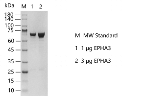 EPHA3-S2301T-H20G-K130613013.png