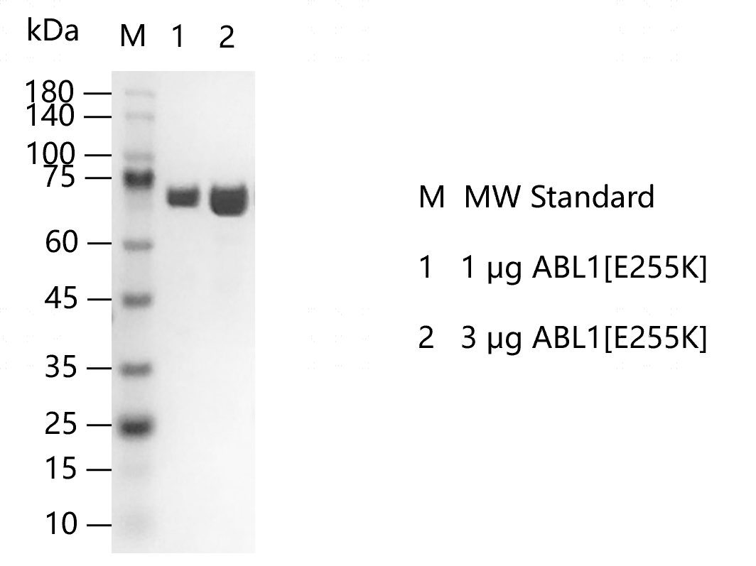 ABL1[E255K] -K140524012.png