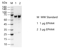 EPHA4-S2301T-H21G-K130404014.png