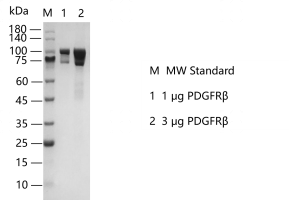 S2402T-H29GF PDGFRβ Protein @G140625011.