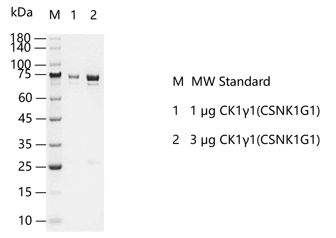 CK1γ1(CSNK1G1) -G130410011.png