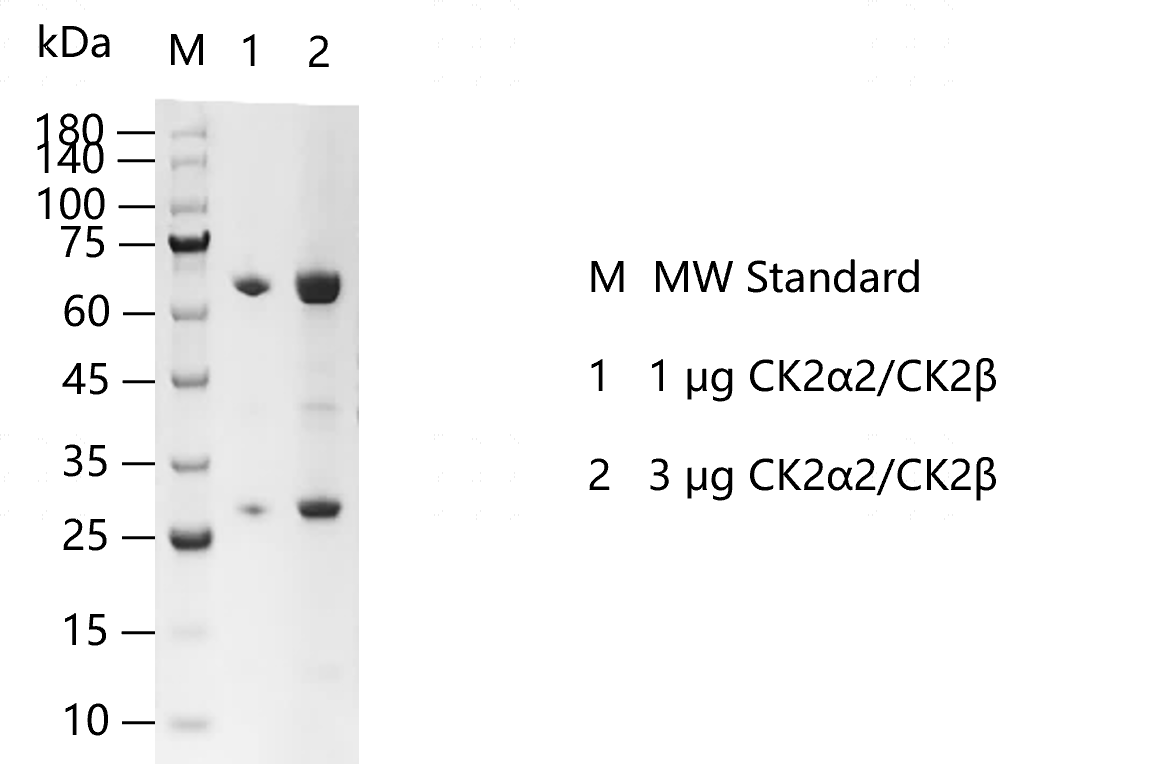 CK2α2-CK2β-G130716012.png