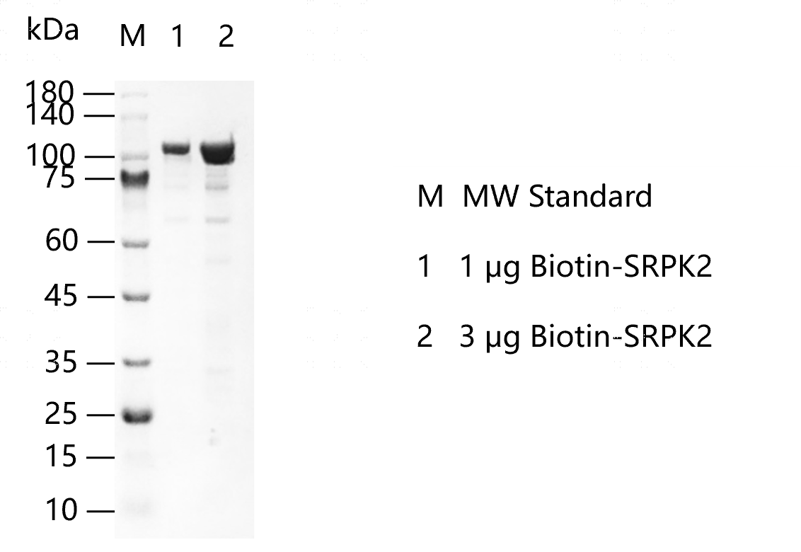 Biotin-SRPK2-K140607013.png