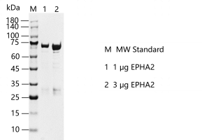 EPHA2-S2301T-H19G-K130403012.png