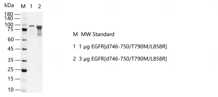 EGFR[d746-750T790ML858R]-S2304T-H36G-G13