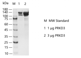 PRKD3-G141112012 .png