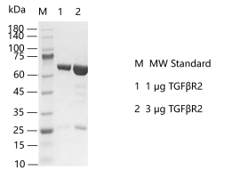 TGFβR2-H141107021.png