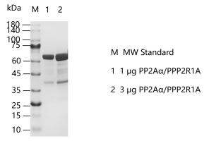 K141105012-PP2Aα PPP2R1A.png