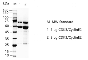K150610011- CDK3 CyclinE2.png