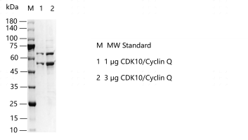 G150702011-CDK10 Cyclin Q.png